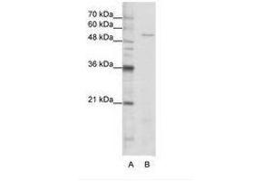 Image no. 1 for anti-Serine--tRNA Ligase, Cytoplasmic-Like (AA 241-290) antibody (ABIN202696) (Serine--tRNA Ligase, Cytoplasmic-Like (AA 241-290) antibody)