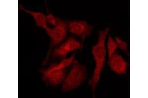 ABIN6275686 staining MCF7 by IF/ICC. (ZC3H11A antibody  (C-Term))