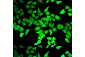Immunofluorescence analysis of MCF-7 cells using HDAC7 Polyclonal Antibody (HDAC7 antibody)