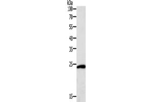 Gel: 12 % SDS-PAGE, Lysate: 40 μg, Lane: Hela cells, Primary antibody: ABIN7131115(SNAP25 Antibody) at dilution 1/400, Secondary antibody: Goat anti rabbit IgG at 1/8000 dilution, Exposure time: 10 seconds (SNAP25 antibody)
