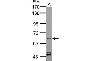 WB Image Sample (50 ug of whole cell lysate) A: mouse muscle 7. (ARIH2 antibody  (C-Term))