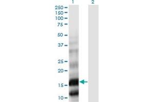 Western Blot analysis of PLA2G10 expression in transfected 293T cell line by PLA2G10 monoclonal antibody (M01), clone 5G11. (PLA2G10 antibody  (AA 64-165))