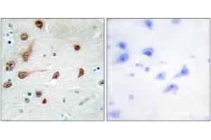 Immunohistochemistry analysis of paraffin-embedded human brain tissue, using ADAR1 Antibody. (ADAR antibody  (AA 1172-1221))