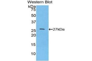 Detection of Recombinant HNF4a, Human using Polyclonal Antibody to Hepatocyte Nuclear Factor 4 Alpha (HNF4a) (HNF4A antibody  (AA 131-330))