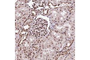 Immunohistochemical staining of human kidney with PDS5B polyclonal antibody  shows strong nuclear positivity in cells in tubules and cells in glomeruli.