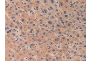 Figure. (ODC1 antibody  (AA 15-259))