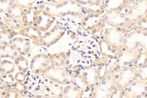 Immunohistochemistry analysis of paraffin-embedded mouse kidney using Integrin alpha V (ABIN7074314) at dilution of 1: 1000 (CD51 antibody)