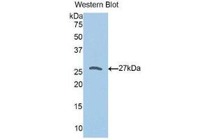 Western Blotting (WB) image for anti-Peroxiredoxin 3 (PRDX3) (AA 5-233) antibody (ABIN1176483) (Peroxiredoxin 3 antibody  (AA 5-233))