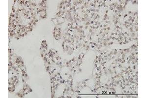 Image no. 5 for anti-DEAD (Asp-Glu-Ala-Asp) Box Polypeptide 54 (DDX54) (AA 778-882) antibody (ABIN599302) (DDX54 antibody  (AA 778-882))