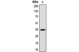 Western blot analysis of APAF-1 expression in HeLa (A) whole cell lysates. (APAF1 antibody  (C-Term))
