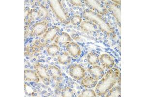 Immunohistochemistry of paraffin-embedded rat kidney using ASPSCR1 antibody (ABIN5975297) at dilution of 1/100 (40x lens). (ASPSCR1 antibody)