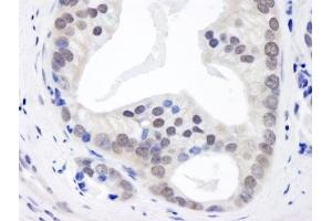 Immunohistochemistry (IHC) image for anti-Casein kappa (CSN3) (AA 325-375) antibody (ABIN7448493) (CSN3 antibody  (AA 325-375))