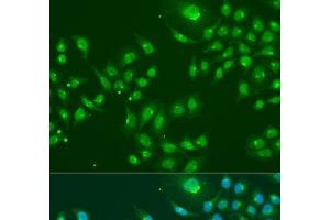 Immunofluorescence analysis of U2OS cells using IFIT3 Polyclonal Antibody at dilution of 1:100. (IFIT3 antibody)