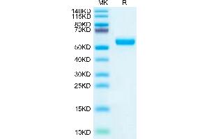 LRP10 Protein (AA 18-441) (His tag)