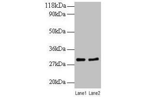 Western blot All lanes: RPL8 antibody at 2 μg/mL Lane 1: EC109 whole cell lysate Lane 2: 293T whole cell lysate Secondary Goat polyclonal to rabbit IgG at 1/10000 dilution Predicted band size: 29 kDa Observed band size: 29 kDa (RPL8 antibody  (AA 3-257))