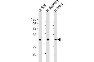 All lanes : Anti-WNT2 Antibody (Center) at 1:2000 dilution Lane 1: Jurkat whole cell lysates Lane 2: human placenta lysates Lane 3: human brain lysates Lysates/proteins at 20 μg per lane. (WNT2 antibody  (AA 254-287))