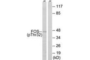 Western blot analysis of extracts from Jurkat cells treated with starved 24h, using FOS (Phospho-Ser32) Antibody. (c-FOS antibody  (pSer32))