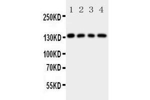 Western Blotting (WB) image for anti-Laminin, gamma 2 (LAMC2) (AA 1160-1180), (C-Term) antibody (ABIN3043156)