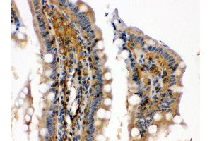 Anti- RAB13 Picoband antibody, IHC(P) IHC(P): Rat Intestine Tissue (RAB13 antibody  (C-Term))