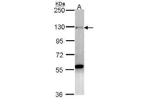 WB Image Sample (30 ug of whole cell lysate) A: H1299 7. (ZNF574 antibody)