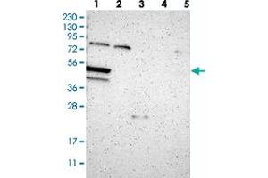 Western blot analysis of Lane 1: RT-4, Lane 2: U-251 MG, Lane 3: Human Plasma, Lane 4: Liver, Lane 5: Tonsil with TNRC4 polyclonal antibody  at 1:250-1:500 dilution.