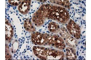 Image no. 1 for anti-Aminoacylase 3 (ACY3) antibody (ABIN1496464) (Aminoacylase 3 antibody)