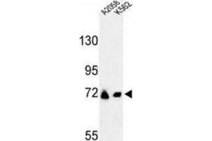 Western Blotting (WB) image for anti-Glutamine-Fructose-6-Phosphate Transaminase 2 (GFPT2) antibody (ABIN3004112)
