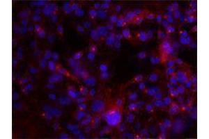 Immunofluorescence (IF) image for anti-Integrin AlphaV, Integrin Beta3 (ITGAV/ITGB3) antibody (ABIN2664760) (CD51/CD61 antibody)
