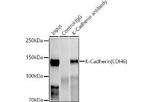 Immunoprecipitation analysis of 300 μg extracts of HepG2 cells using 3 μg K-Cadherin (CDH6) antibody (ABIN1680831, ABIN3019147, ABIN3019148 and ABIN7101722). (CDH6 antibody)