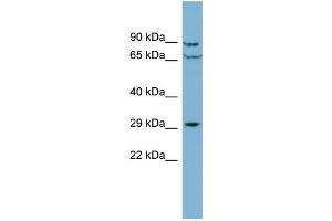 WB Suggested Anti-CUTC Antibody Titration: 0. (CUTC antibody  (Middle Region))