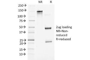 SDS-PAGE Analysis of Purified Beta-Catenin (p120) Monoclonal Antibody (5H10). (CTNNB1 antibody  (C-Term))