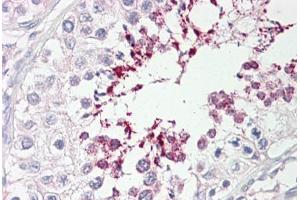 Image no. 2 for anti-ATPase, Class V, Type 10D (ATP10D) (AA 1154-1203) antibody (ABIN6749742)