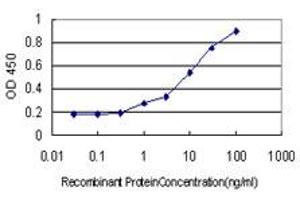 Detection limit for recombinant GST tagged DEF6 is approximately 1ng/ml as a capture antibody. (DEF6 antibody  (AA 1-336))