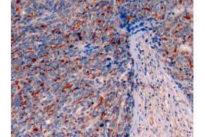 Immunohistochemistry (IHC) image for anti-Mucin 1 (MUC1) (AA 1034-1151) antibody (ABIN7438133)
