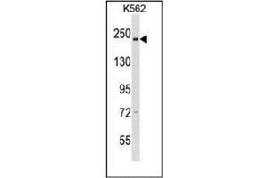 Western blot analysis of CAPD3 Antibody (C-term) in K562 cell line lysates (35ug/lane). (NCAPD3 antibody  (C-Term))