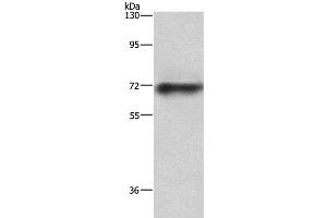 Western Blot analysis of Mouse heart tissue using ABCB8 Polyclonal Antibody at dilution of 1:750 (ABCB8 antibody)