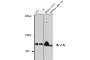 Western blot analysis of extracts of various cell lines, using NDUFB1 antibody (ABIN7268808) at 1:1000 dilution. (NDUFB1 antibody  (AA 1-105))