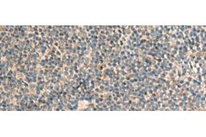 Immunohistochemistry of paraffin-embedded Human tonsil tissue using POFUT1 Polyclonal Antibody at dilution of 1:50(x200) (POFUT1 antibody)