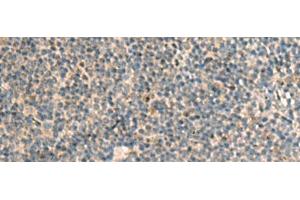 Immunohistochemistry of paraffin-embedded Human tonsil tissue using POFUT1 Polyclonal Antibody at dilution of 1:50(x200)