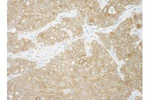 Immunohistochemistry (IHC) image for anti-Ancient Ubiquitous Protein 1 (Aup1) (AA 426-476) antibody (ABIN7454882)