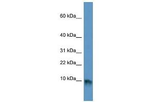 EGF antibody used at 1 ug/ml to detect target protein. (EGF antibody)