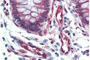 Human Colon (formalin-fixed, paraffin-embedded) stained with SERPINH1 antibody ABIN364502 at 5 ug/ml followed by biotinylated anti-mouse IgG secondary antibody ABIN481714, alkaline phosphatase-streptavidin and chromogen. (SERPINH1 antibody)