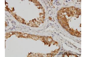 Immunoperoxidase of monoclonal antibody to MAPK13 on formalin-fixed paraffin-embedded human testis. (MAPK13 antibody  (AA 251-365))