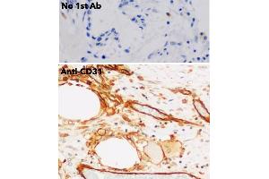 Immunohistochemistry (IHC) image for anti-Platelet/endothelial Cell Adhesion Molecule (PECAM1) (C-Term) antibody (ABIN6254202)