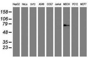 Image no. 2 for anti-Golgi Membrane Protein 1 (GOLM1) antibody (ABIN1498496) (GOLM1 antibody)