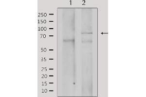 Western blot analysis of extracts from mouse brain, using GRK3 Antibody. (ADRBK2 antibody  (Internal Region))