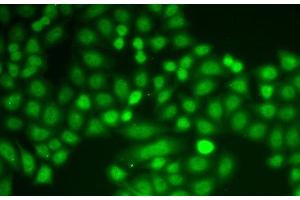 Immunofluorescence analysis of A549 cells using ASC / TMS1 Polyclonal Antibody (PYCARD antibody)