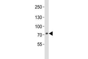 Western Blotting (WB) image for anti-Proprotein Convertase Subtilisin/kexin Type 9 (PCSK9) (AA 479-508) antibody (ABIN3032342)