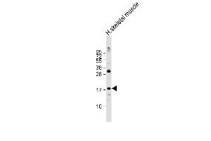 Anti-ND4L Antibody (C-term) at 1:2000 dilution + human skeletal muscle lysate Lysates/proteins at 20 μg per lane. (MT-ND4L antibody  (C-Term))