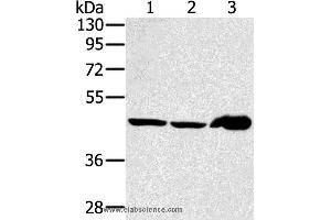 Western blot analysis of Mouse liver tissue and PC3 cell, human fetal liver tissue, using SEC14L2 Polyclonal Antibody at dilution of 1:400